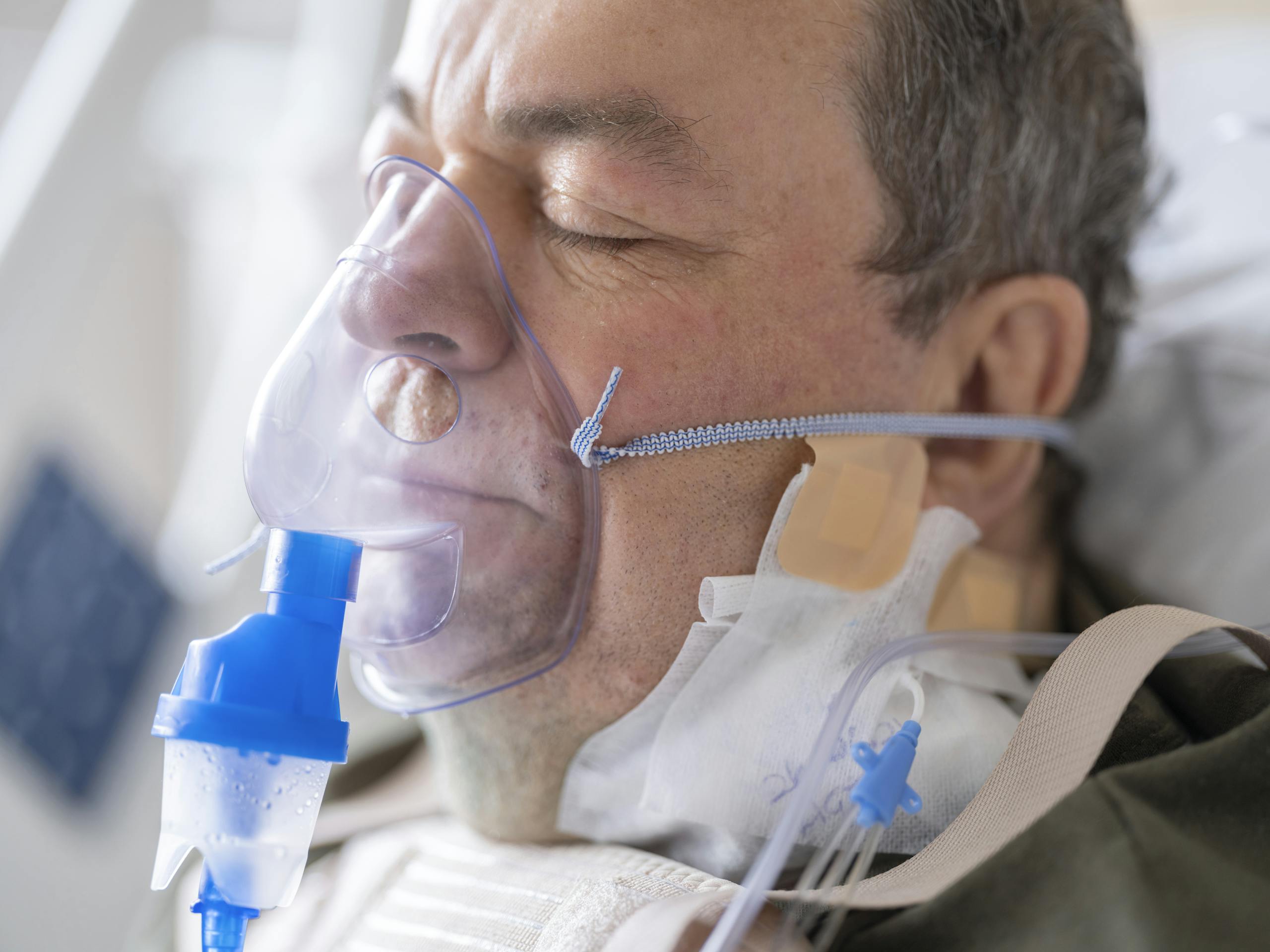 AERD (Aspirin Exacerbated Respiratory Disease) Close-up of a senior patient wearing an oxygen mask in a hospital setting.