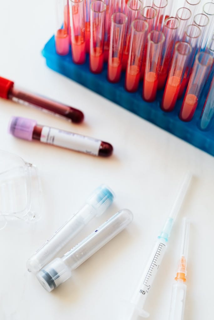Laboratory blood samples, test tubes, and syringe on white background.